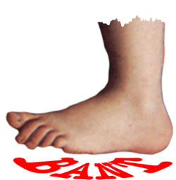 ban_bant_torn